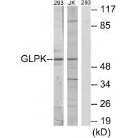 GLPK Antibody[33749]