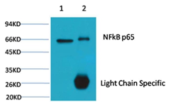 NFκB p65 Mouse Monoclonal Anti