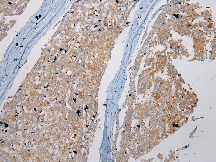 NUDT6 Antibody[43373]