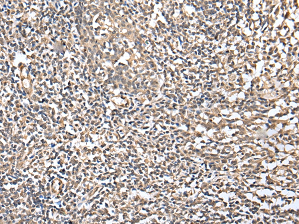 CSRP3 Antibody[42970]
