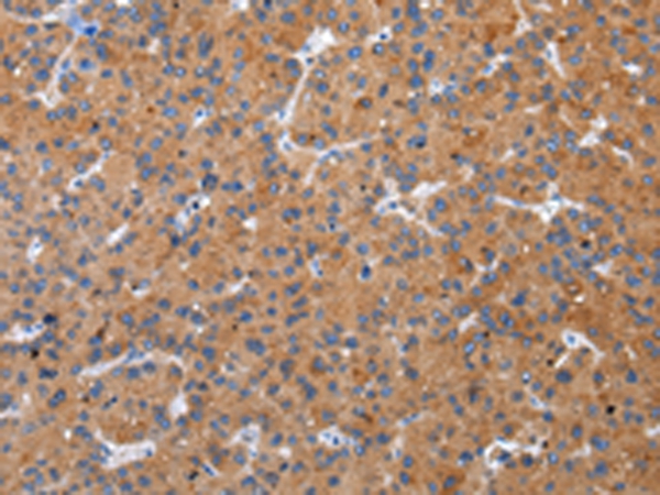 ZFAND2A Antibody[43205]