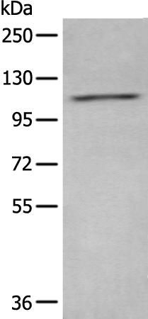 ADCY2 Antibody[43960]