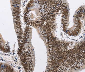 CMTM2 Antibody[35683]