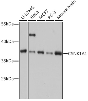 CSNK1A1 Rabbit Polyclonal Anti