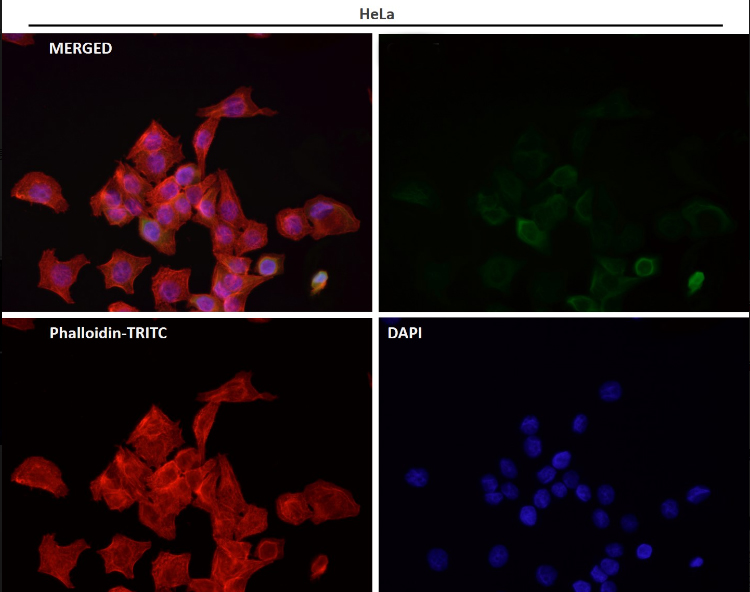 CDK6 Rabbit mAb[52213]