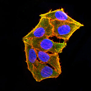 LRRK2 Mouse mAb[63887]