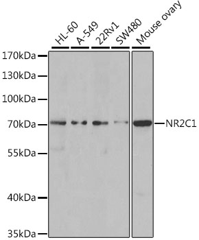NR2C1 Rabbit Polyclonal Antibo