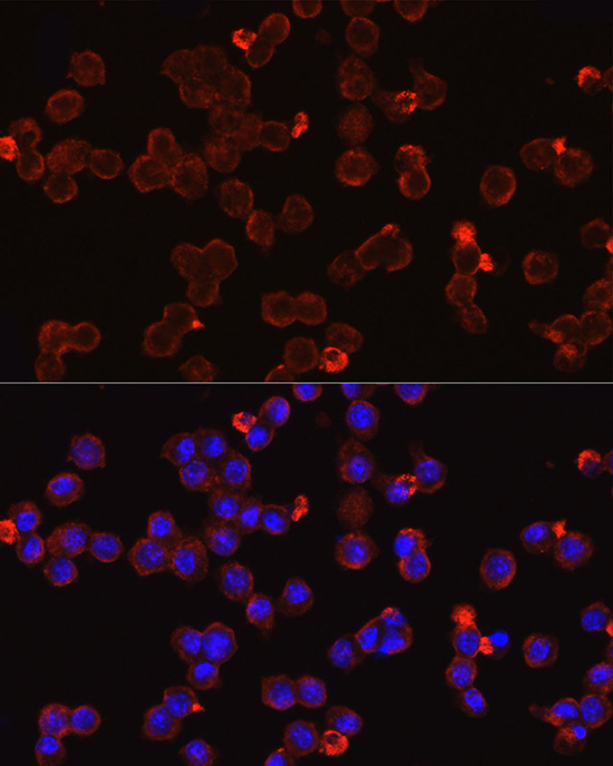 IRAK4 antibody[38750]
