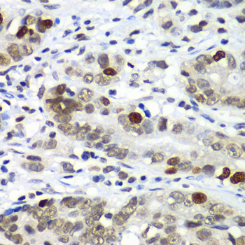 DR1 Rabbit Polyclonal Antibody