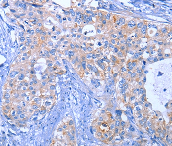 ACVR2B Antibody[35646]