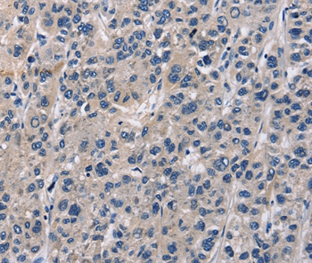 ABI3BP Antibody[36249]
