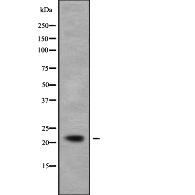 NCALD Antibody[46084]