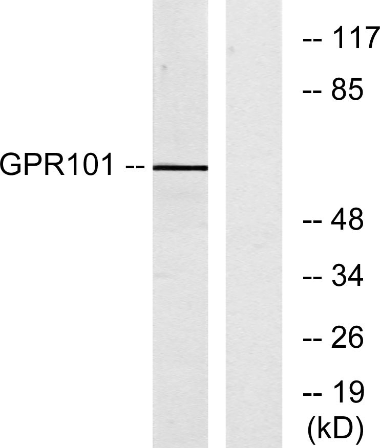 GPR101 Polyclonal Antibody[409