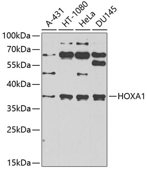 HOXA1 Rabbit Polyclonal Antibo