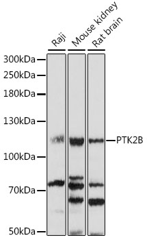 PTK2B Rabbit Polyclonal Antibo