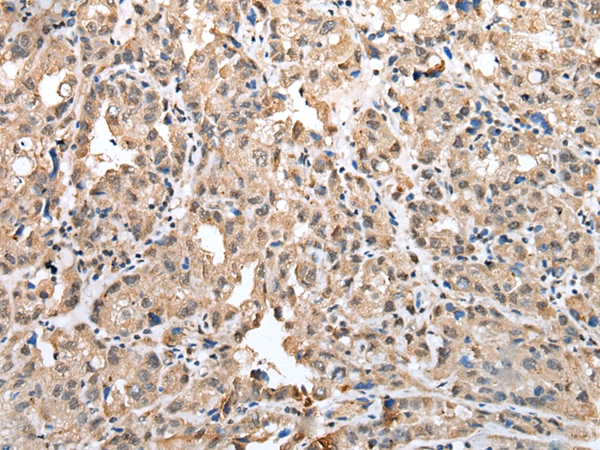 CSRP3 Antibody[42970]