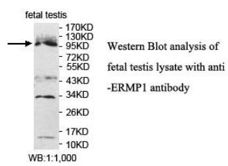 ERMP1 Antibody[40050]