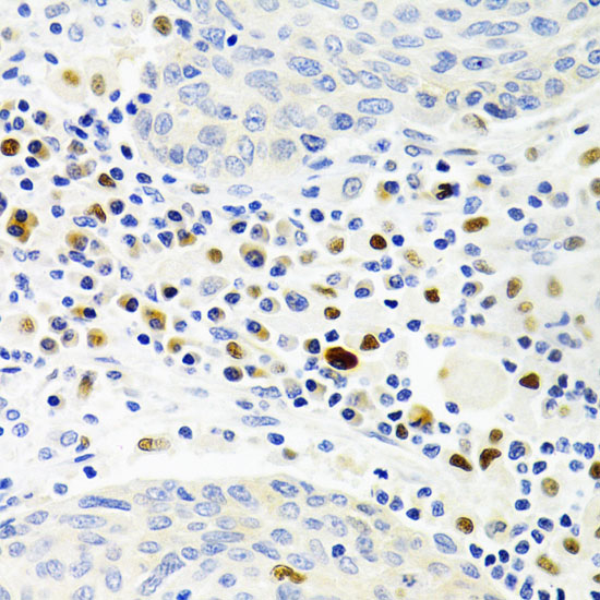 GEMIN2 antibody[38570]