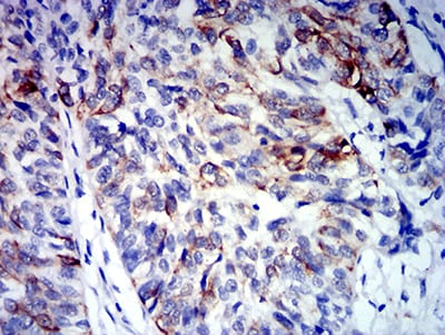 CD64 Mouse mAb[63412]