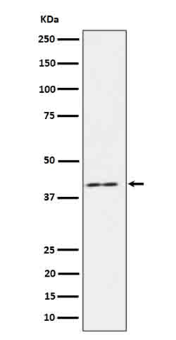 IL18 binding protein Antibody[