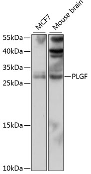 PLGF Rabbit Polyclonal Antibod