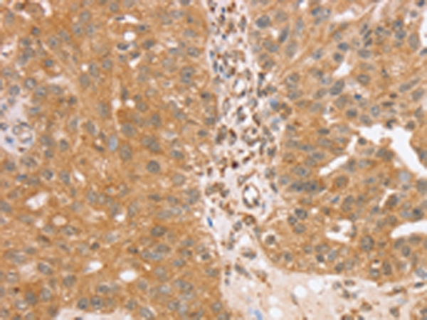 TRIM25 Antibody[43160]