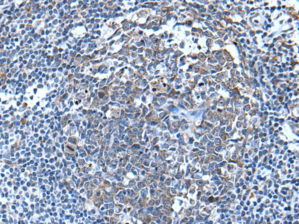 WFDC12 Antibody[43809]