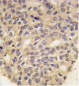 PINK1 Mouse Monoclonal Antibo