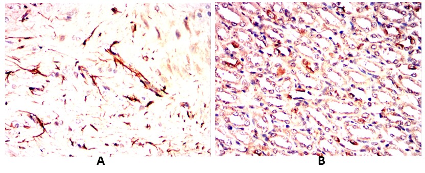 TNFSF11 Mouse mAb[64341]