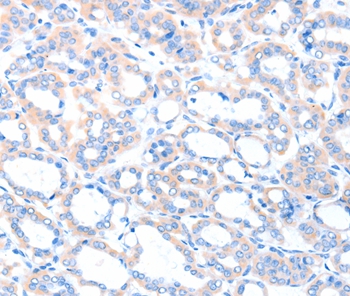 ACSM5 Antibody[36025]