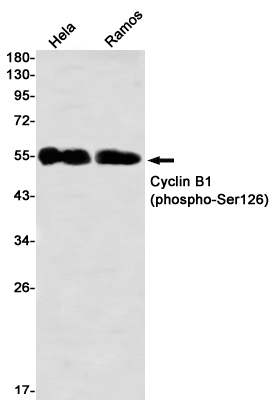 Phospho-Cyclin B1 (Ser126) Rab