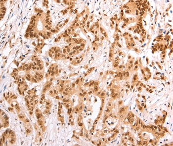 TAX1BP1 Antibody[35972]