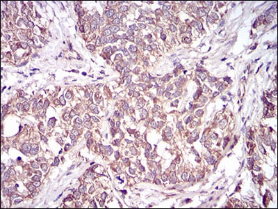 CD36 Mouse mAb[63374]