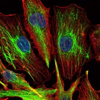 KLHL22 Mouse mAb[63834]