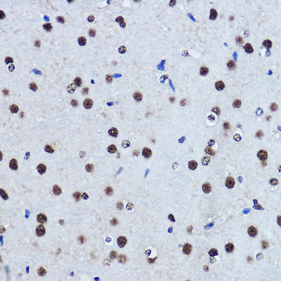 TARDBP Rabbit Polyclonal Antib