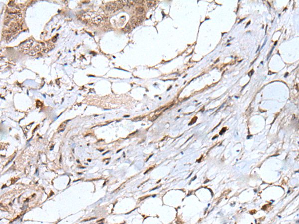 UBN1 Antibody[43829]