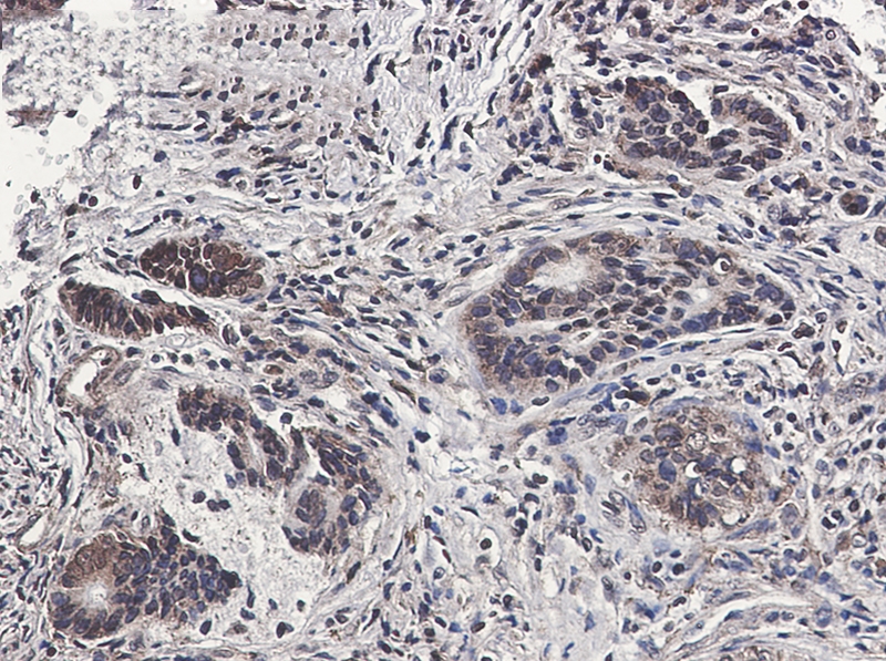 MST1 Rabbit mAb[52672]