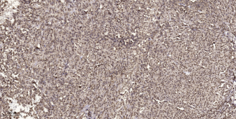 TIS11D Polyclonal Antibody[489