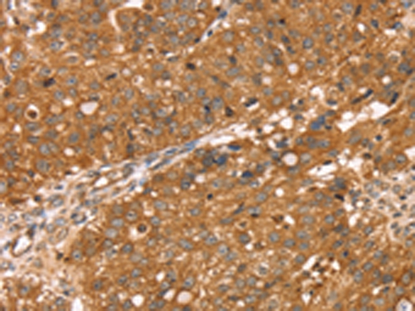 RNASET2 Antibody[42738]