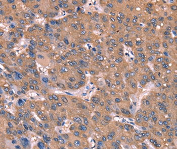GCSAM Antibody[37588]