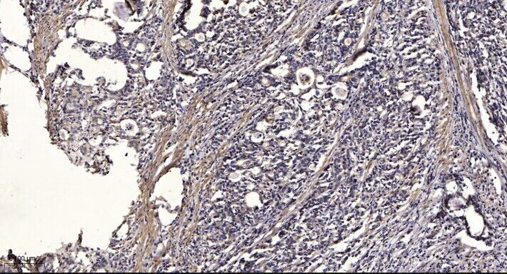 IRF-7 (phospho-Ser471/472) rab