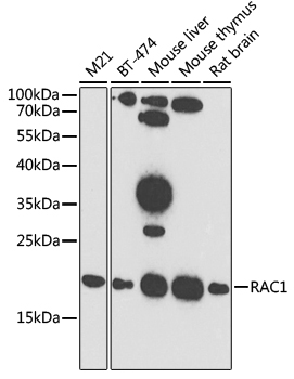 RAC1 Rabbit Polyclonal Antibod
