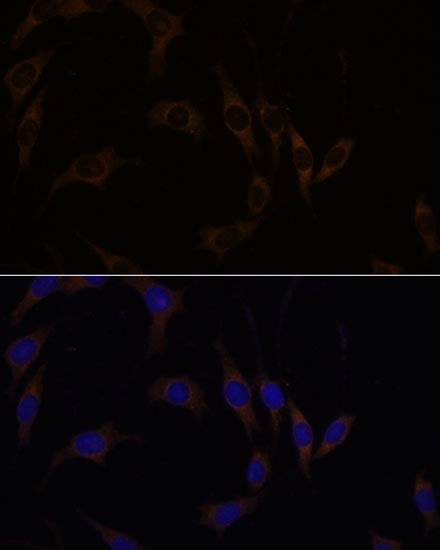 RGS4 Rabbit Polyclonal Antibod