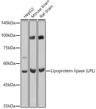 LPL Rabbit Polyclonal Antibody