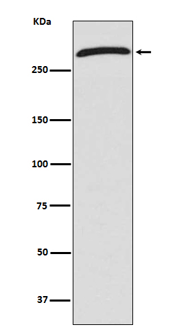 CHD4 Rabbit mAb[56169]