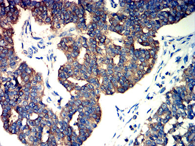 M6PR Mouse mAb[63892]