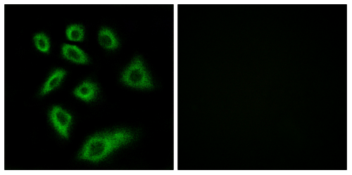 CYP2W1 Polyclonal Antibody[491