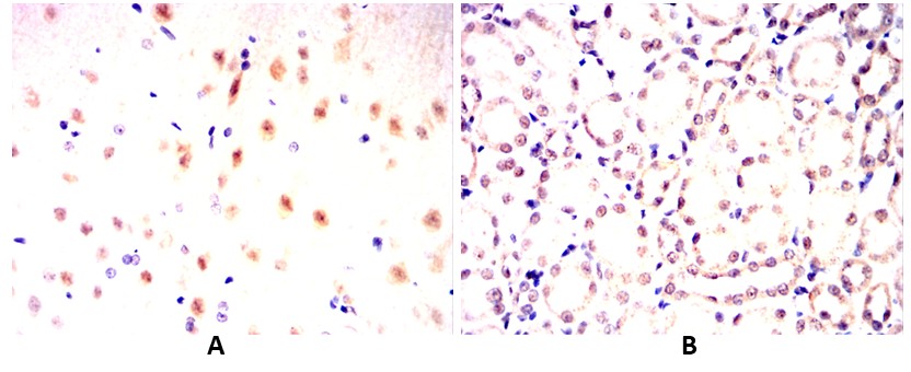 ATXN1 Mouse mAb[63121]
