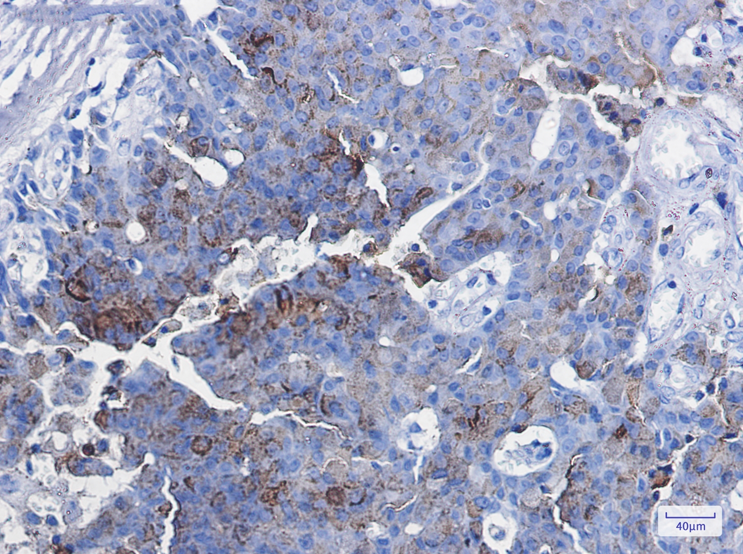 CD63 Rabbit mAb[52208]