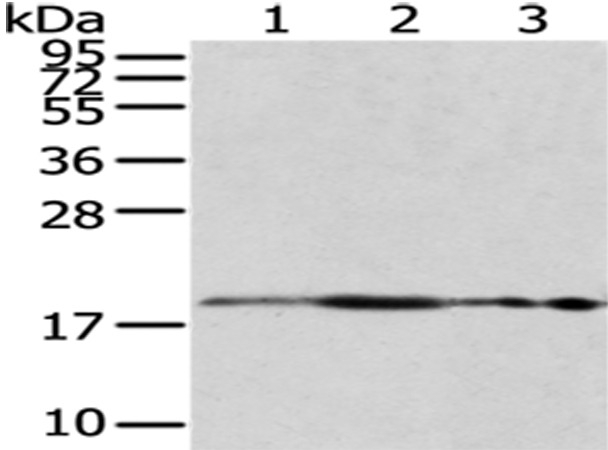 RPS10 Antibody[43045]